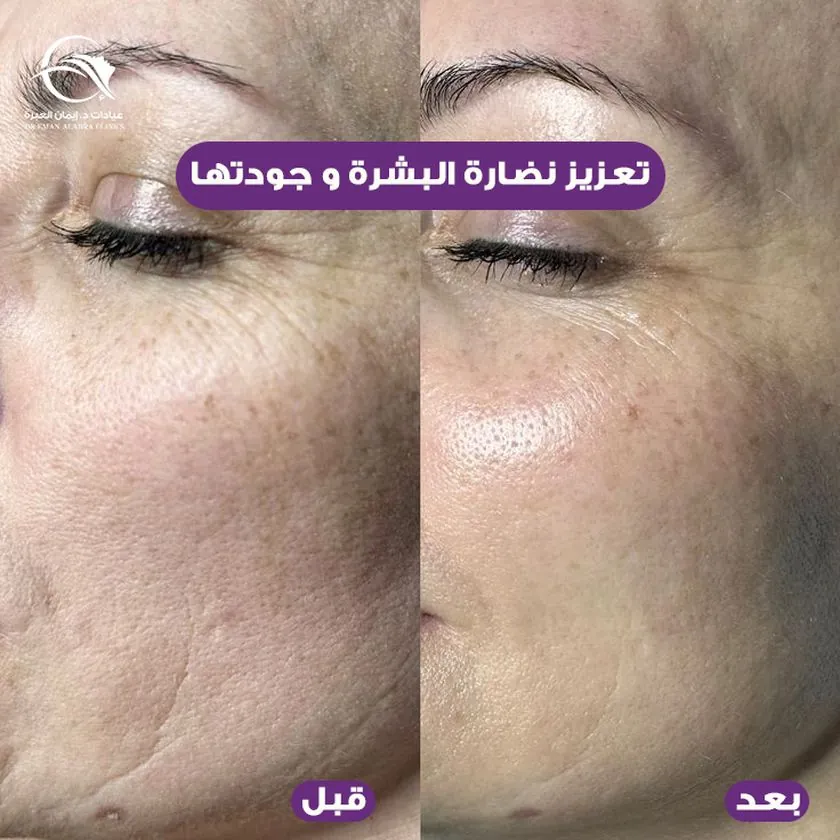 تعزيز نضارة البشرة وجودتها