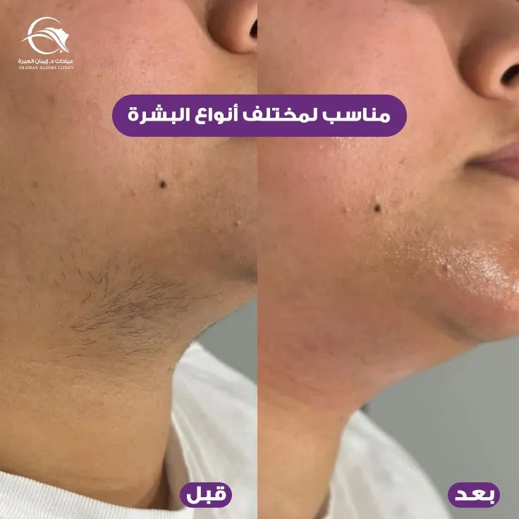 مناسب لمختلف أنواع البشرة