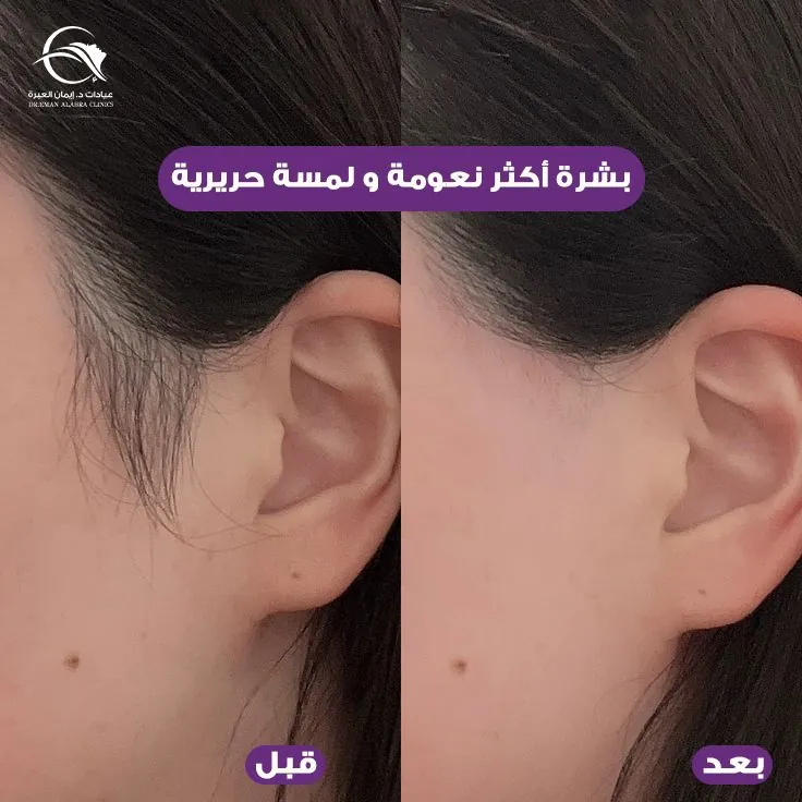 بشرة أكثر نعومة ولمسة حريرية